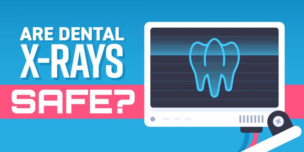 Newsletter_Blog_Are_Dental_X-Rays_Safe_1200x600