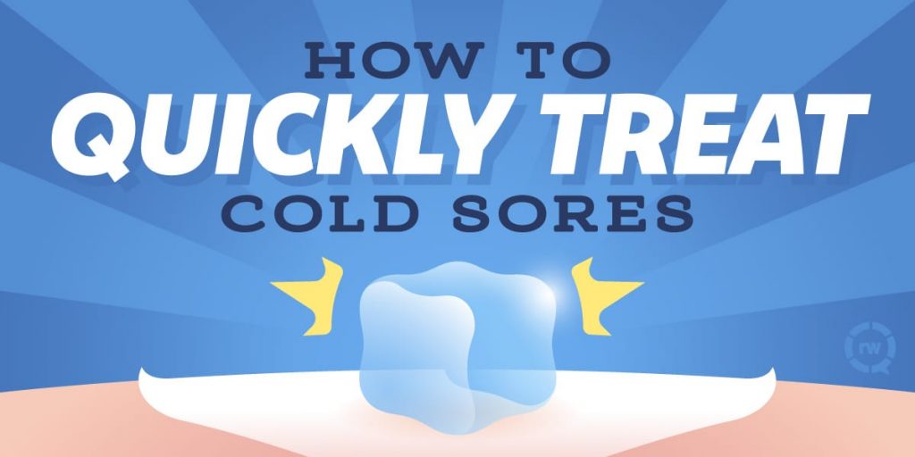 cold sores